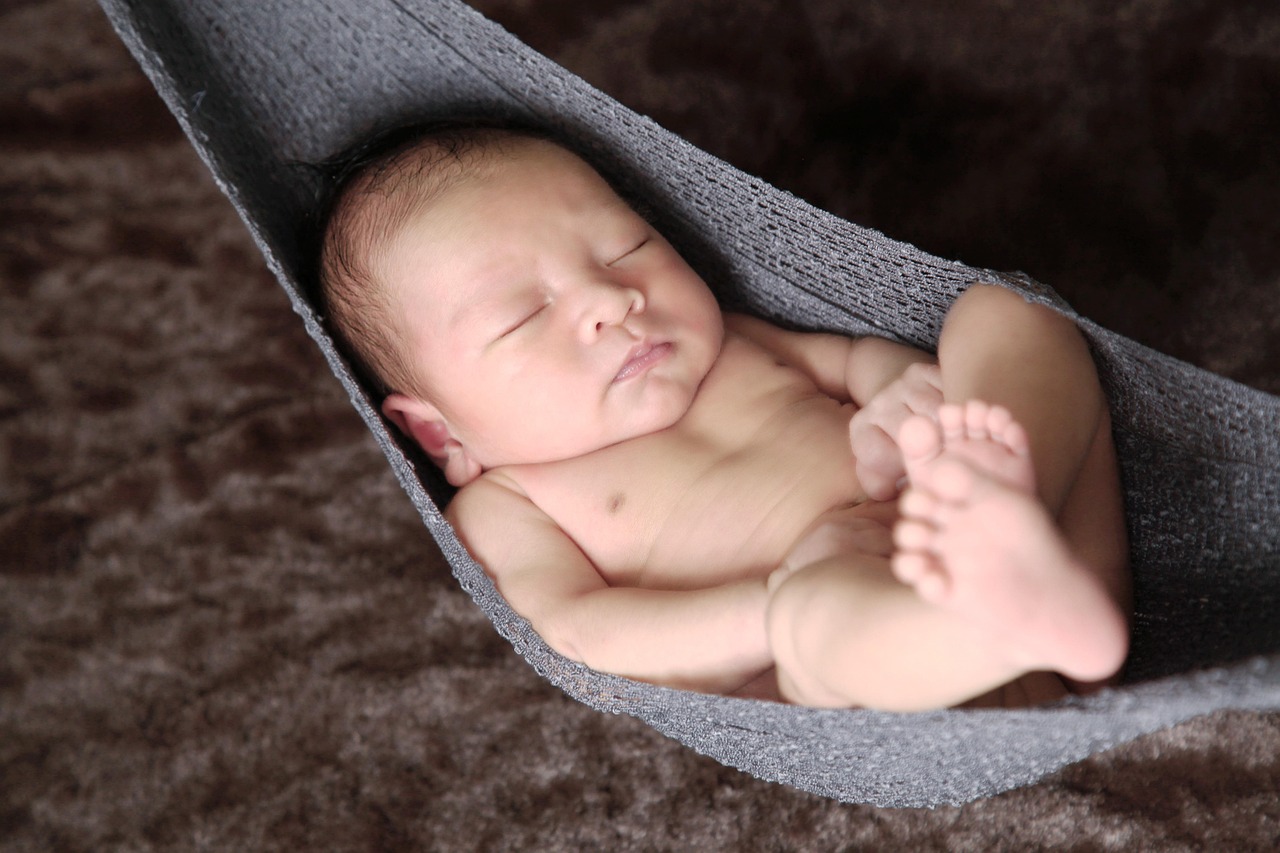 hidrocel congenital